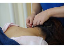 鍼灸と整体技術×丁寧なカウンセリングで寄り添います。