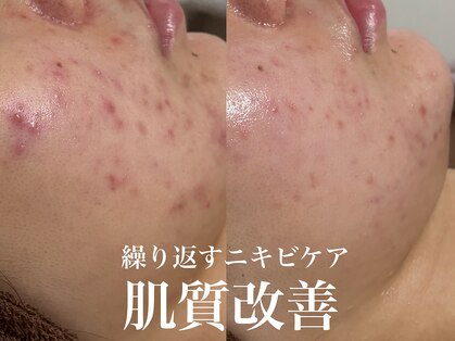 メロー(MELLOW)の写真