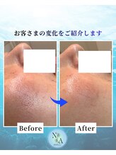 夏秋美肌サロン/Before-After