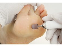 フットアドバンス 成城店/フットケア【角質 魚の目】