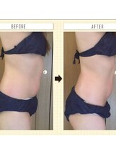 ピアリーノ(Pialino)/お腹集中　全身痩身