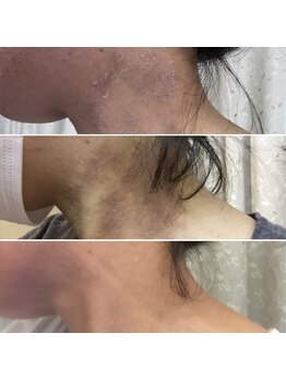 ドルフィン(Dolphin)/★スタッフビフォーアフター