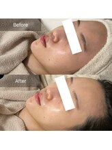 ステムサロン(stem salon)/ビフォーアフター