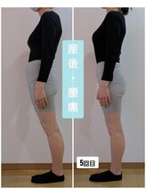 ポノ(Pono)/産後骨盤矯正