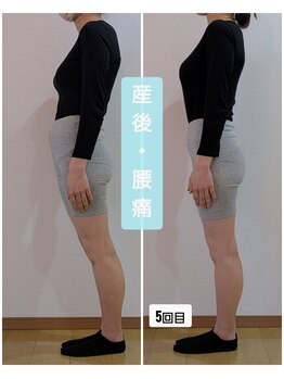 ポノ(Pono)/産後骨盤矯正