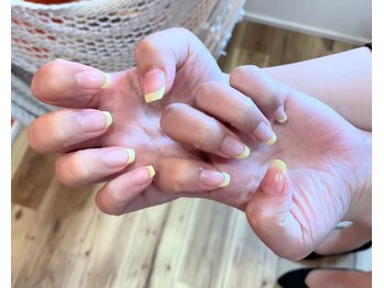 フィーラ(Feela)/シェラック 定額制