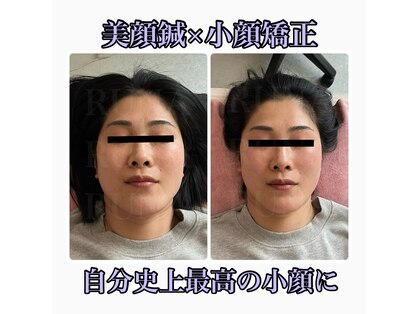 ビプラス(BePlus)の写真