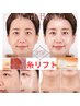 【しわ/たるみ改善】最先端塗る糸リフト 老け見え撃退フェイシャル90分/9,800