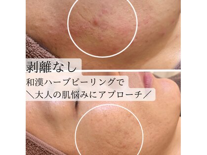 なかま鍼灸整骨院の写真