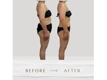 肩こり改善と同時にボディラインまで整う