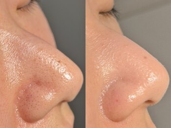 ルーナジェーナ(Luna llena)/