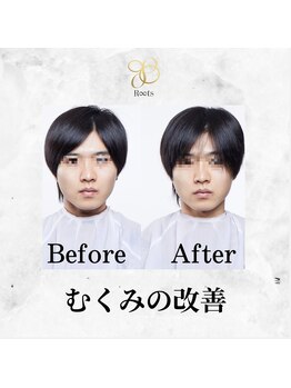 ルーツ(R∞ts)/お顔のむくみ改善で小顔に！