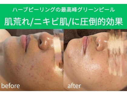 デイジーの写真