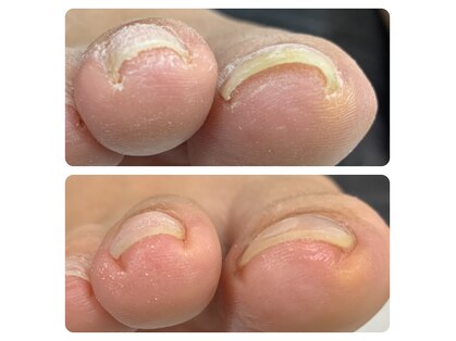 ネイルサロン ミツ(Nailsalon 32)の写真
