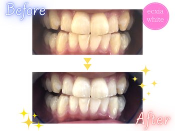 エクシアホワイトニング 王寺店/