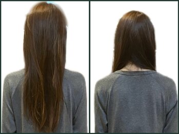 練馬アカデミア美容整体院/姿勢/巻き肩/肩高さ/肩盛上がり