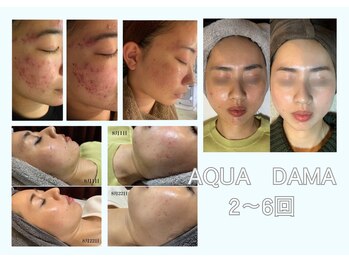 リジュベネーションサロン アリス(Alice)/アクアダーマB&A