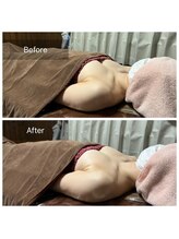 リノレア(LinoLea)/バストアップBefore after