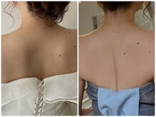 リンパドレナージュラナ(Rana)の雰囲気（美背中を手に入れるっ♪すっきり肩甲骨で肩の辛さも融和します）
