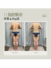 FJ/脂肪撃退コース＼９キロ減／