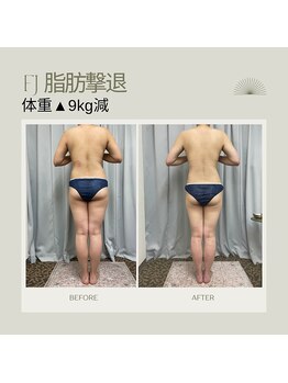 FJ/脂肪撃退コース\9キロ減/