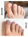 【美爪育成】《フット》深爪改善