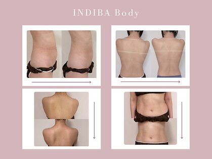 ミーティスの写真