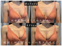 エステティックサロン パヒューム(Esthetic Salon Perfume)/挙式でドレスを綺麗に着たい