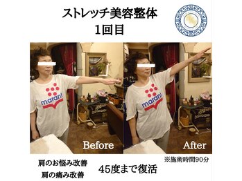 RKY/肩のお悩み改善(ごじゅうかた)