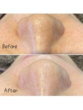 アルディート(Ardito)/美肌WAX脱毛