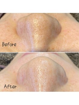 アルディート(Ardito)/美肌WAX脱毛