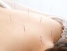 【鍼灸/整体】睡眠ケア60分