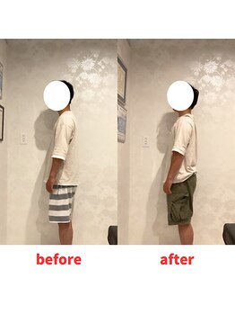 ナオル整体 福岡香椎院(NAORU整体)/30代男性施術事例【猫背改善】
