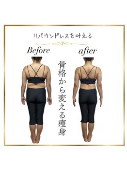 ビチル 薬院(美chill)/骨格矯正・痩身