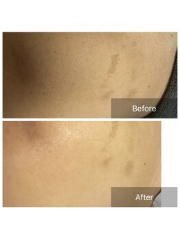 ダンニヒル(dannihil)/【おしりケア】座りっぱなしで