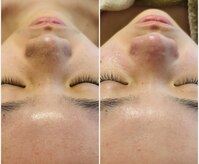 ラインビューティ 上野 御徒町(LINE BEAUTY)
