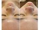 ラインビューティ 上野 御徒町(LINE BEAUTY)の写真