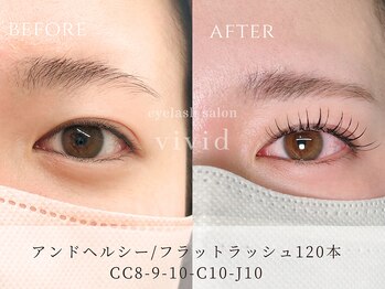 ビビッド(vivid)/パリエク進化版【&Healthy】