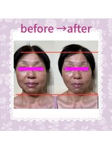 ビサイド(美side)/【美sideフェイシャル】