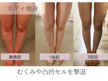 ニコリ 大宮(NICORI)/ボディ痩身