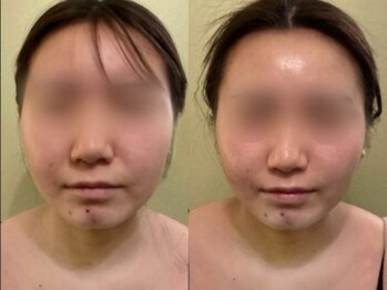 サロンハート(Salon Heart)/