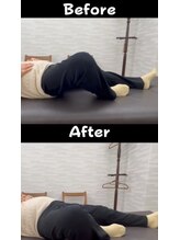 タブチ神経整体院 西宮院/股関節の痛み