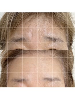 ファソ ブロウアンドアイズ(fasol)/美肌筋エステ