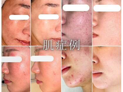韓国肌管理室 ソア(soa)の写真