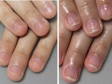オズ ネイルアンドアイ(OZ NAIL&EYE)の雰囲気（爪のコンプレックやケアや深爪育成メニューで清潔感ある指先に！）