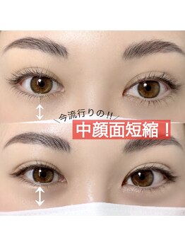 アンナボーテ(Anna beate)/いま流行りの中顔面短縮！