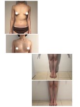 美人バスト 川崎店/【痩身・ダイエット】 川崎/脚☆