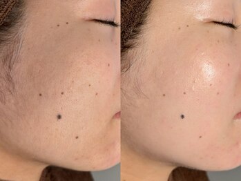 ルーナジェーナ(Luna llena)/池袋 エステ ルーナジェーナ