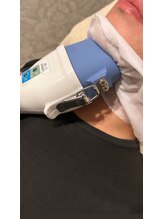 シェリール(CHIRIEUR)/気になる二重アゴに！