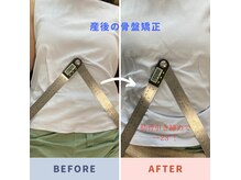 ブリーザ(breather)の雰囲気（産後骨盤矯正と肋骨矯正でくびれ作り！食事制限なしで-5kgへ☆）